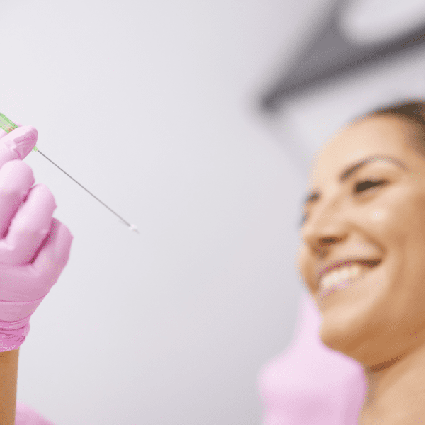 PDO Facial Threads Lift
