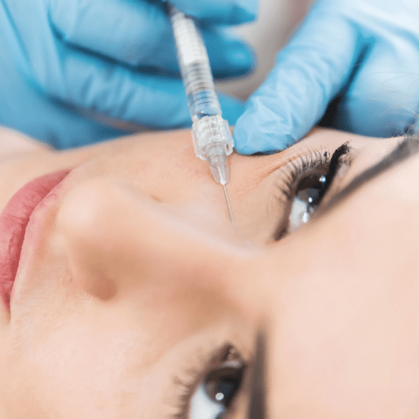 Tear Trough Fillers