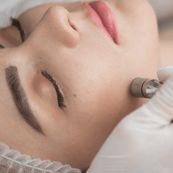 Facial & Microdermabrasion