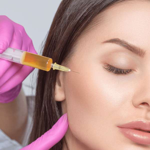 Facial Platelet Rich Plasma (PRP)